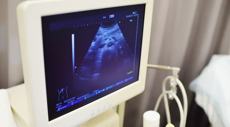 Bezpieczeństwo USG podczas ciąży - czy jest to bezpieczne badanie?